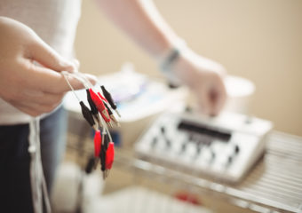 Electro-acupuncture